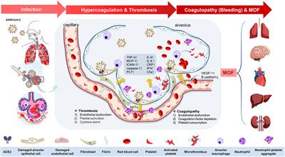 Thrombosis and Coagulopathy in COVID-19: Current Understanding and Implications for Antithrombotic Treatment in Patients Treated With Percutaneous Coronary Intervention